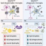 Masnoće u mozgu kao skriveni pokretač Alzheimerove bolesti